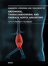 Thoracic Aneurysm Symptoms Treatment