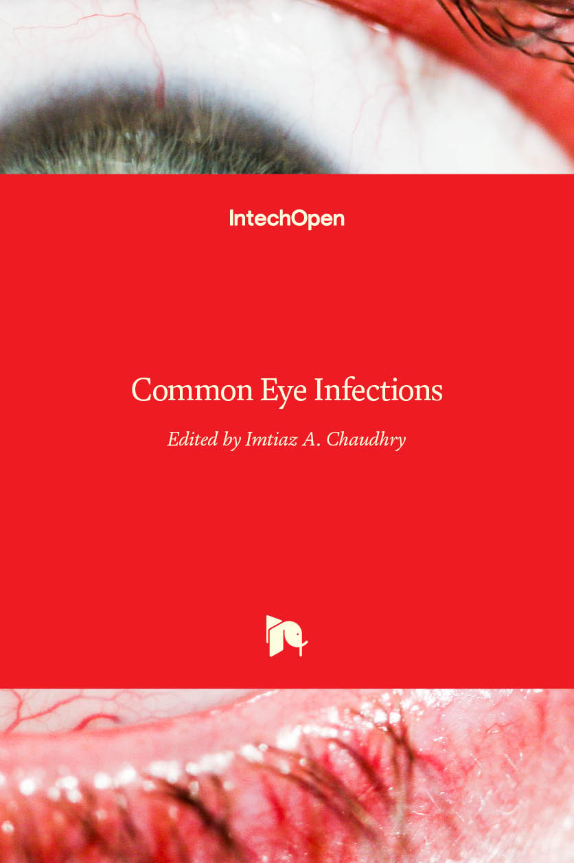 Common Eye Infections Intechopen 