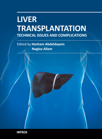 Liver Transplantation Technical Issues And Complications Intechopen