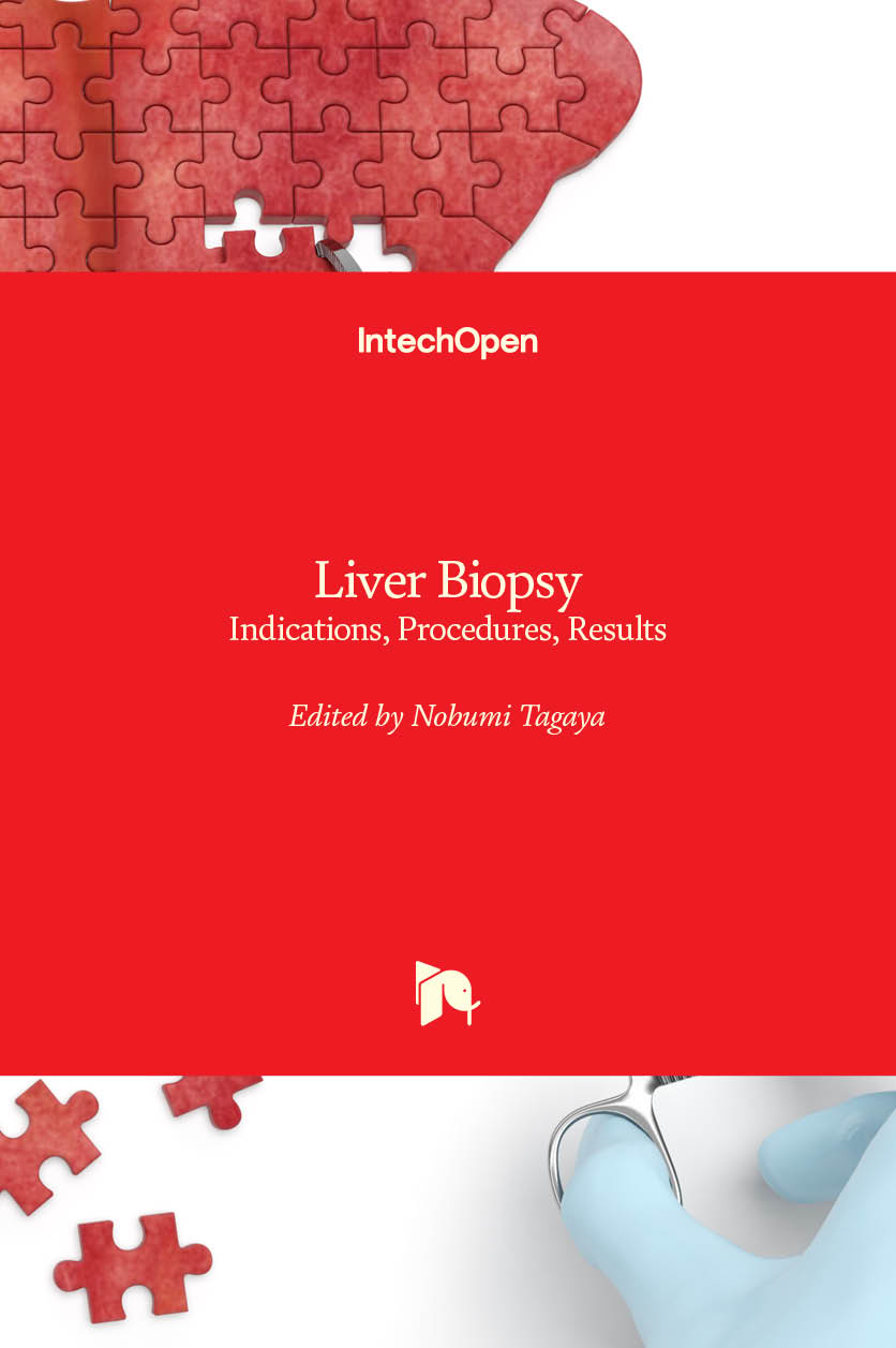 Liver Biopsy - Indications, Procedures, Results