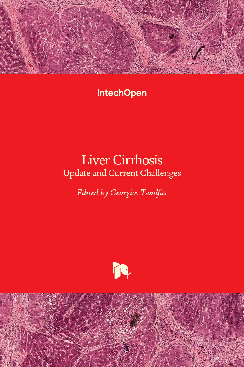 Liver Cirrhosis - Update and Current Challenges