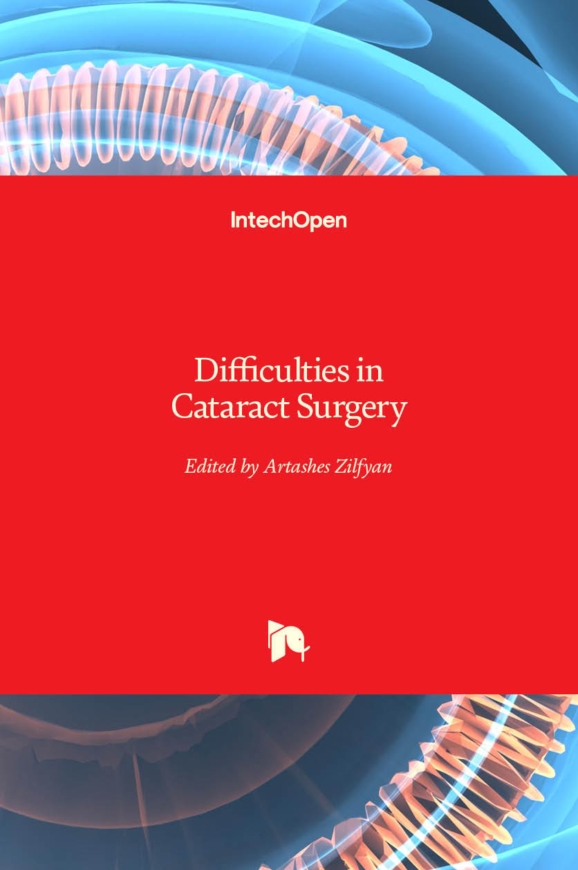 Difficulties in Cataract Surgery