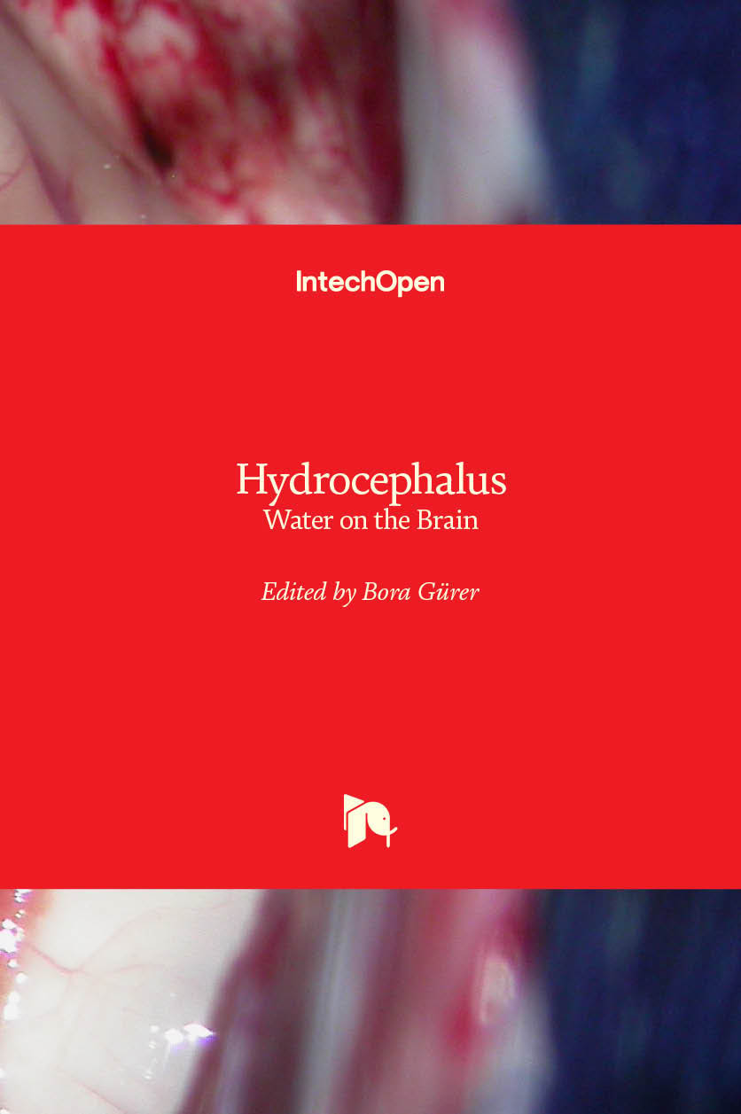 Hydrocephalus - Water on the Brain