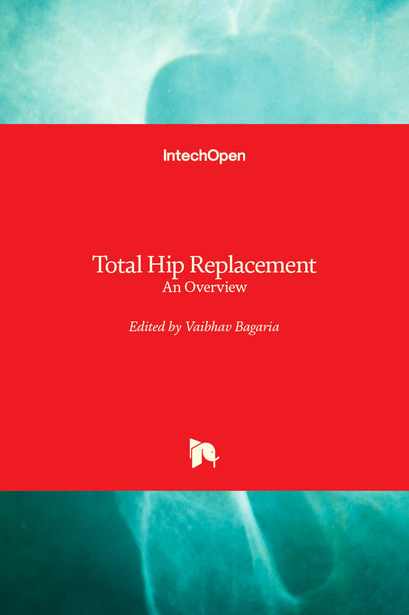 Total Hip Replacement - An Overview