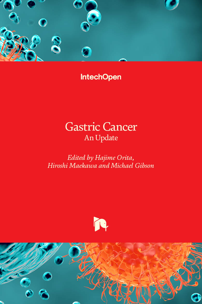Gastric Cancer - An Update
