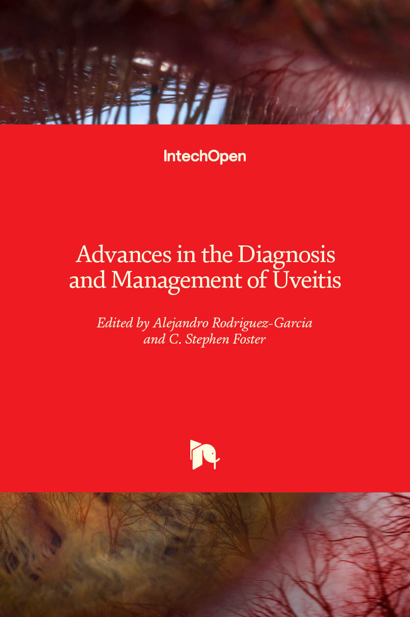 Advances in the Diagnosis and Management of Uveitis