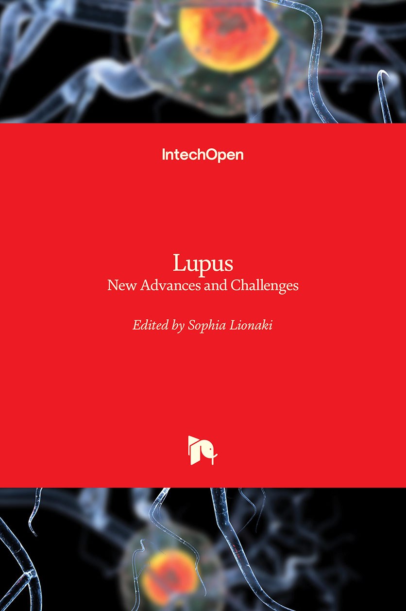 Lupus - New Advances and Challenges