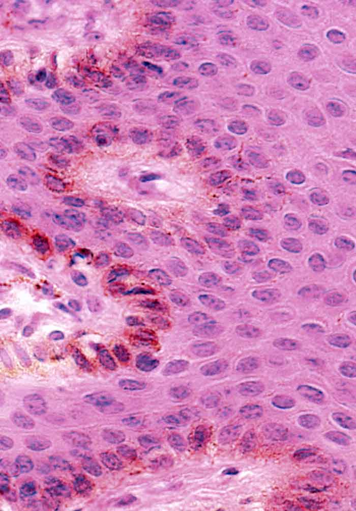 keratinocyte histology