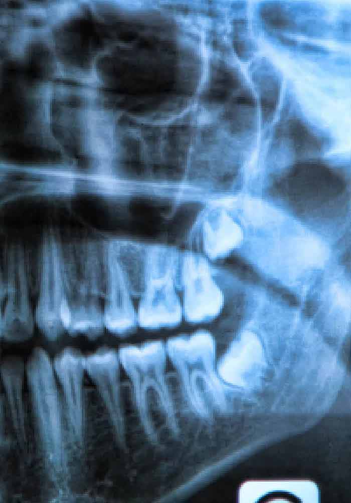 maxillofacial surgery intechopen