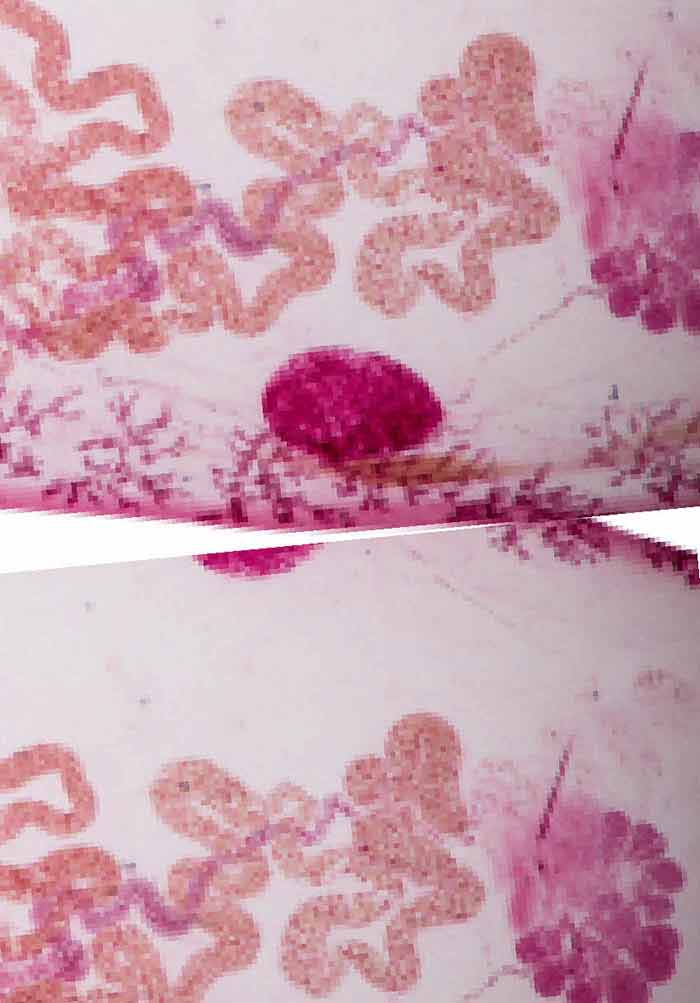 Helminthes széklet mikroszkópos fénykép Helmint diagnozis