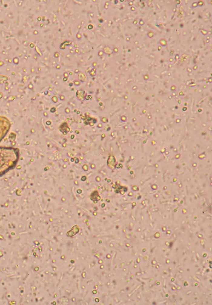 giardia low white blood cell count)