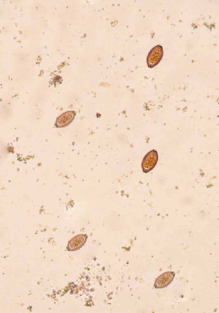 schistosomiasis zoonosis)